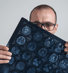 Neurological Symptoms