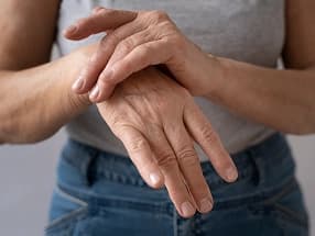 Rheumatoid Arthritis
