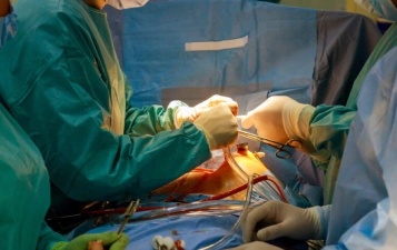 Aortic Surgery