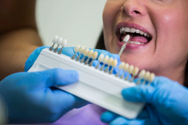 Dental Implants