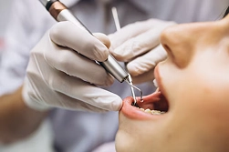 Endodontics