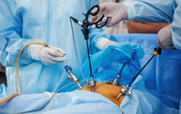 Endoscopy