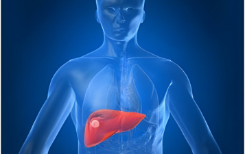 Liver Biopsy