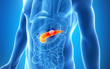 Pancreatic Treatment