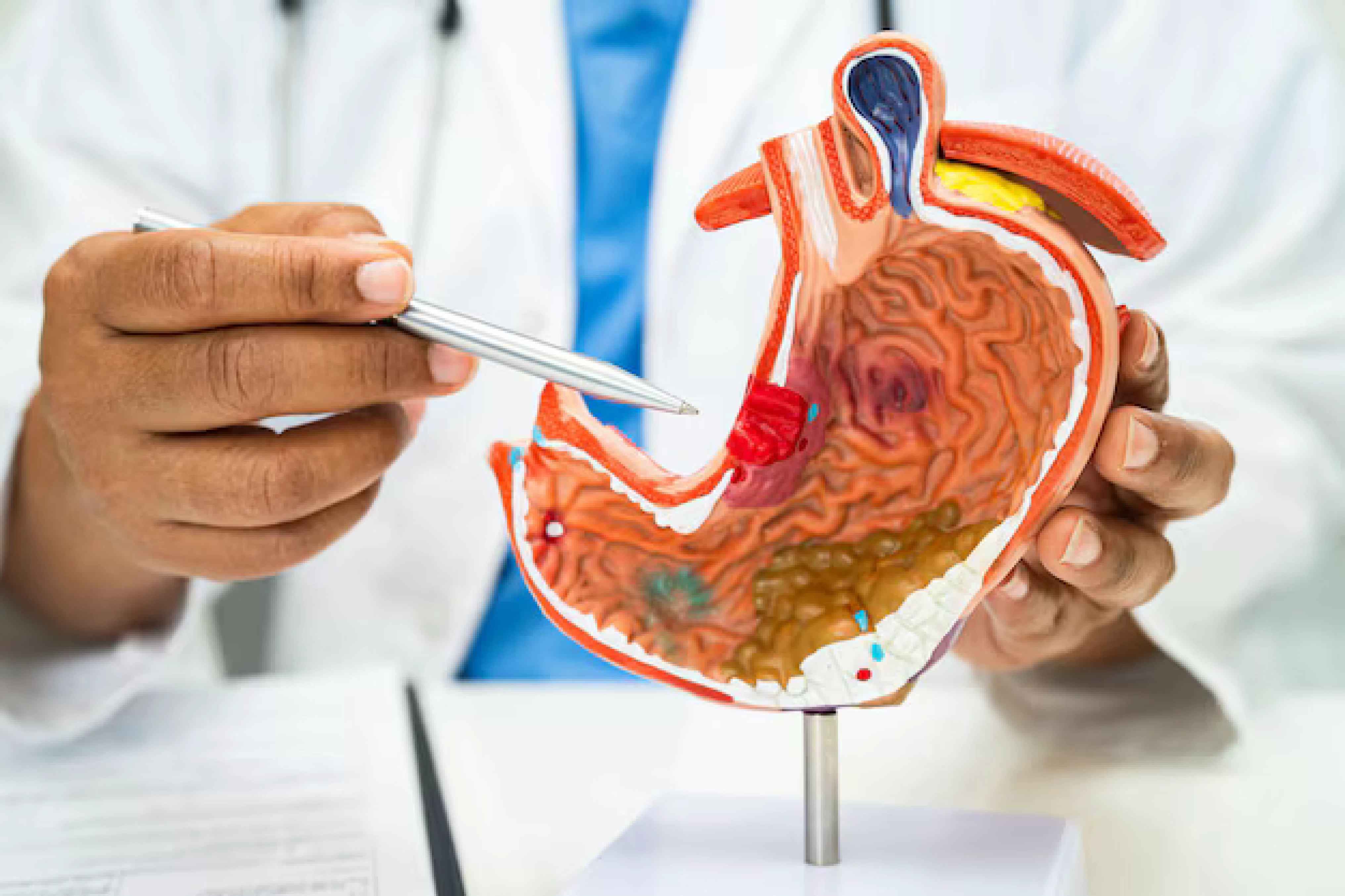 Bowel Resection