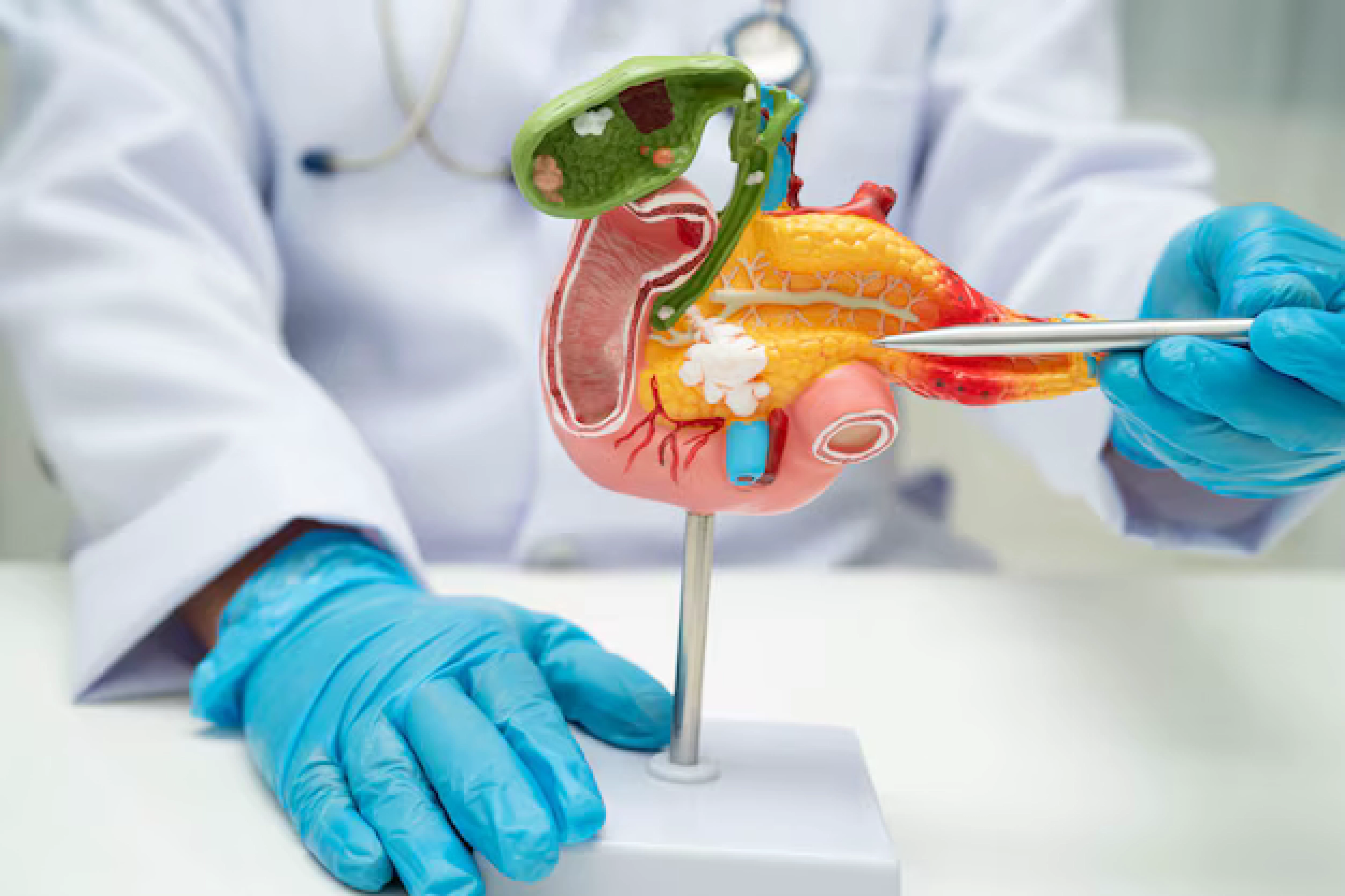 Gallbladder Surgery