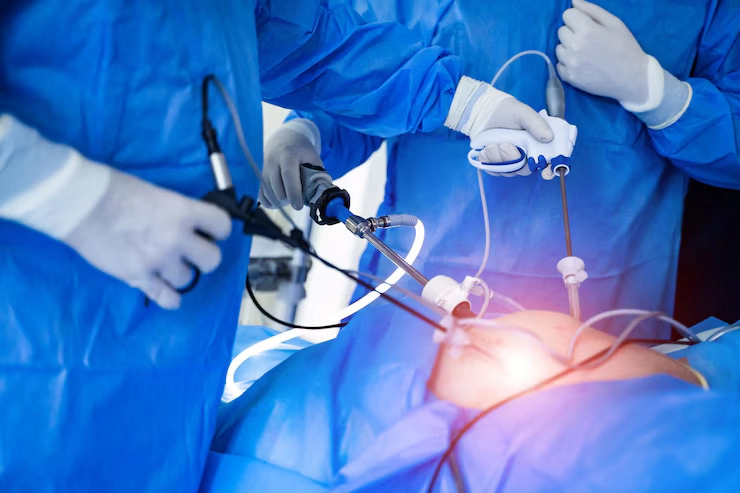 Minimally Invasive Procedures