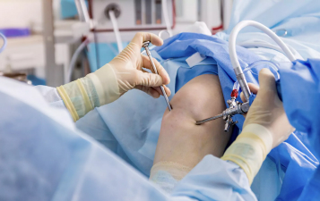 Arthroscopic Surgery