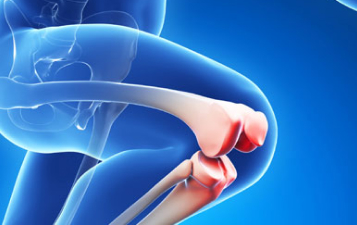 Joint Replacement Surgery