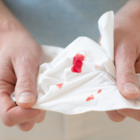 Abnormal Bleeding or Discharge