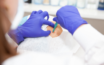 Biopsy & Diagnostic Services