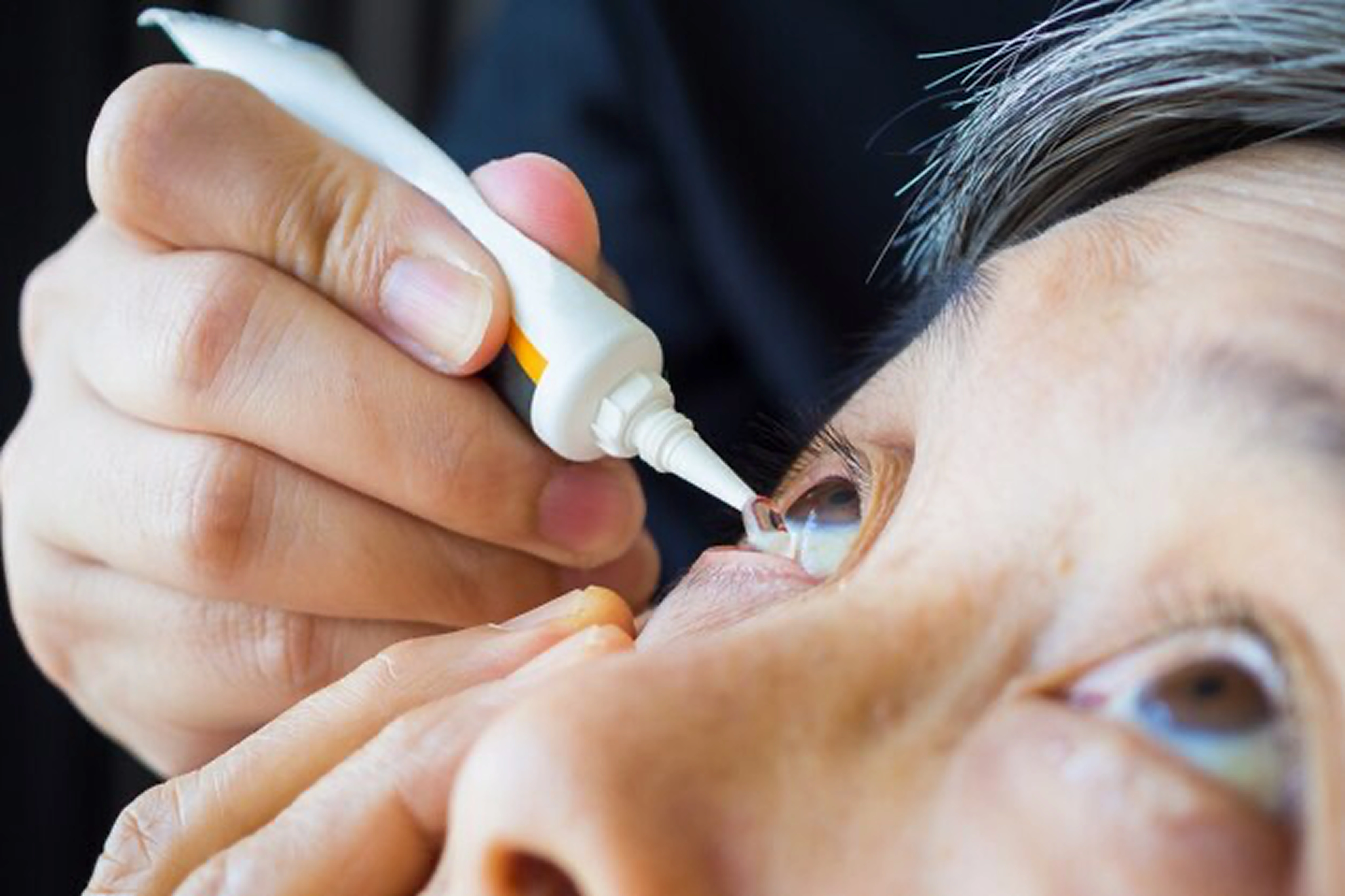 Glaucoma Management
