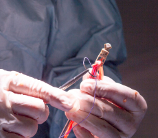 Minimally Invasive Techniques