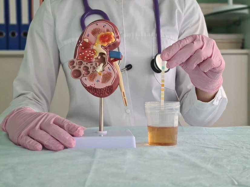 Urinary Tract Infection (UTI) Treatment