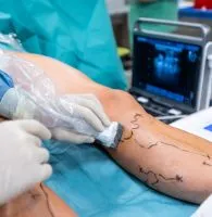 Comprehensive Vascular Care