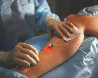 Endovenous Laser Ablation (EVLA)