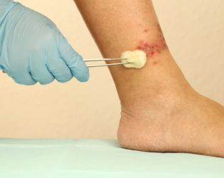 Leg Ulcer & Wound Care