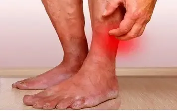 Skin Changes Around the Ankle