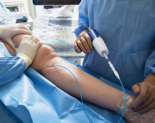 VenaSeal Glue Therapy
